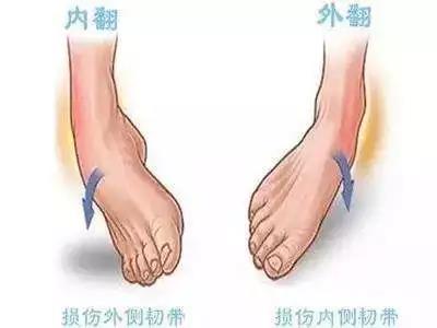 踝足矯形器（AFO）的使用及注意事項(xiàng)